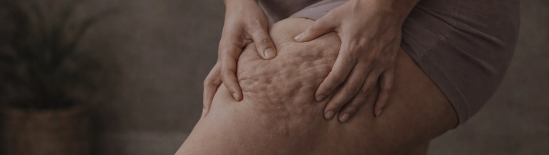 CELULITIDA: proč to není tuk a proč tělo potřebuje bezpečí, ne tlak