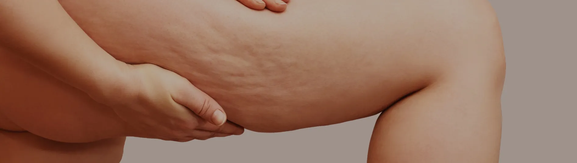 Best place of true splander