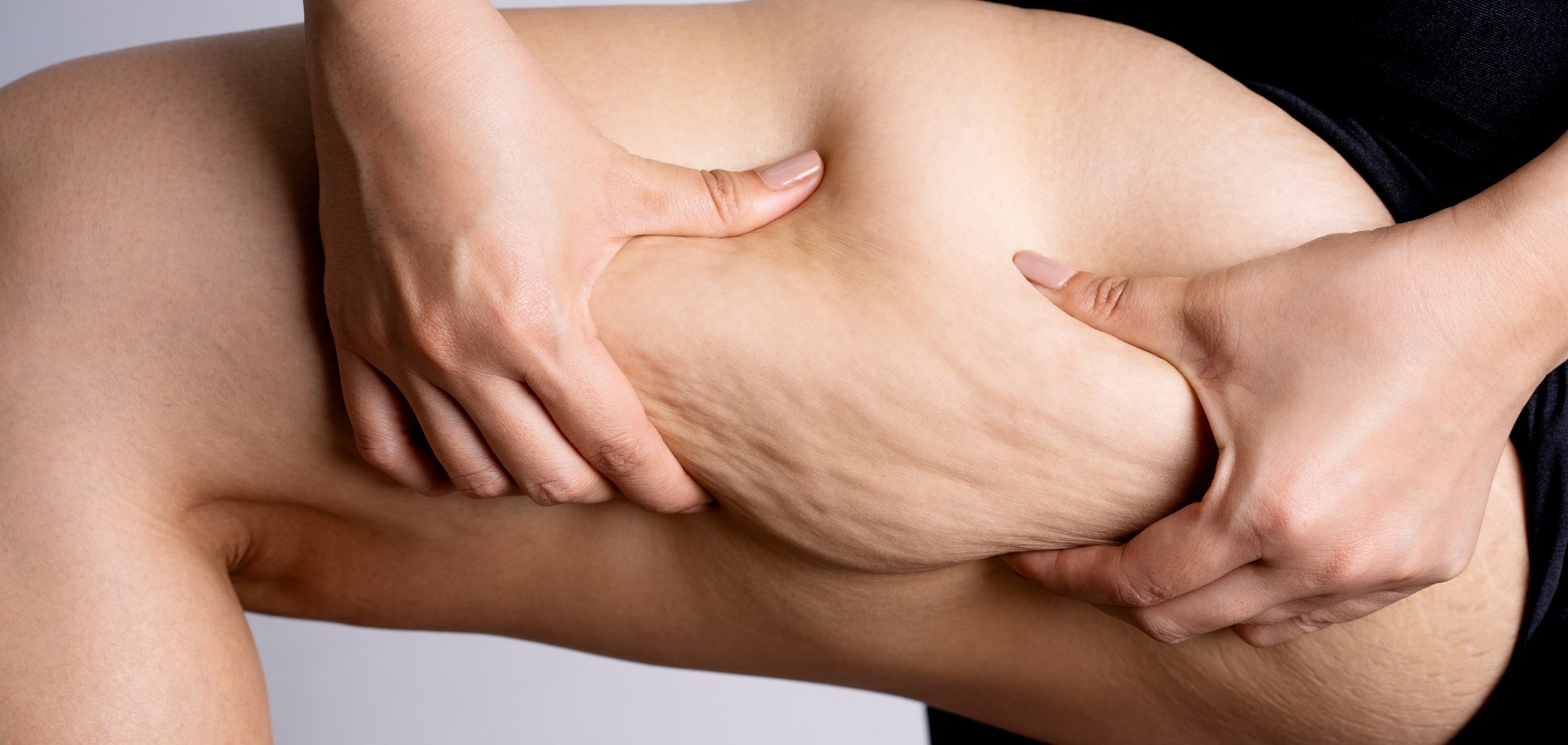 Detail tkáně reagující na tlak – celulitida jako signál ztuhlé a přetížené tkáně, nikoli tuk. 